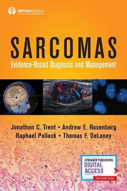 Sarcomas 3/e