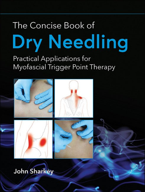 The Concise Book of Dry Needling