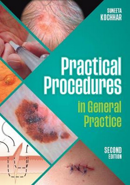 Practical Procedures in General Practice, second edition 2/e