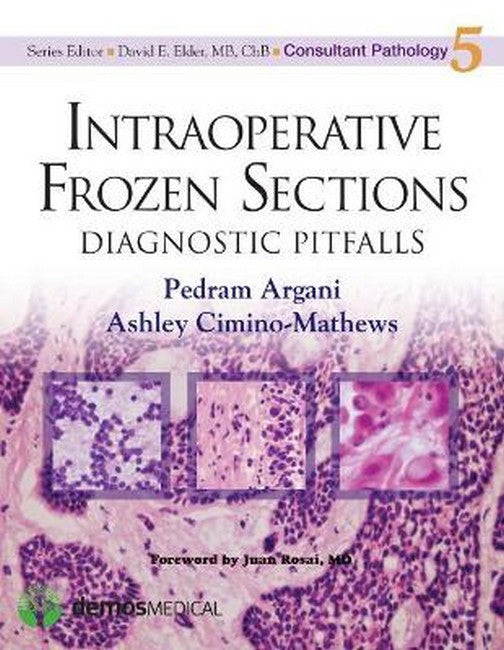 Intraoperative Frozen Sections 2/e