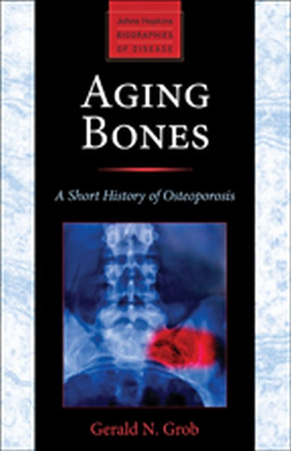 Aging Bones