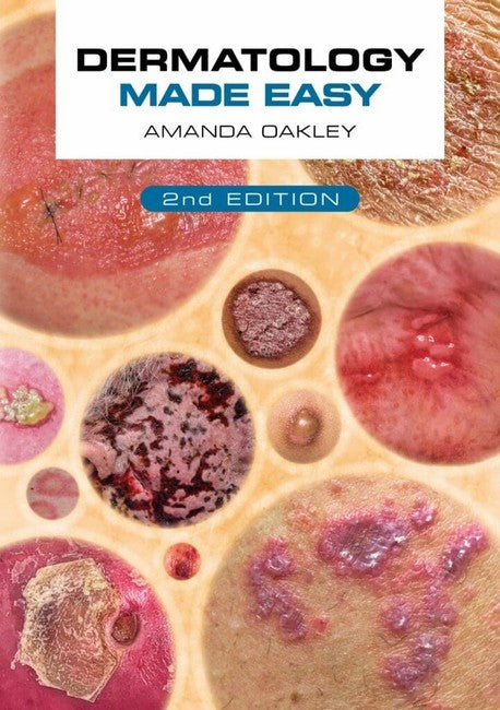 Dermatology Made Easy, second edition 2/e